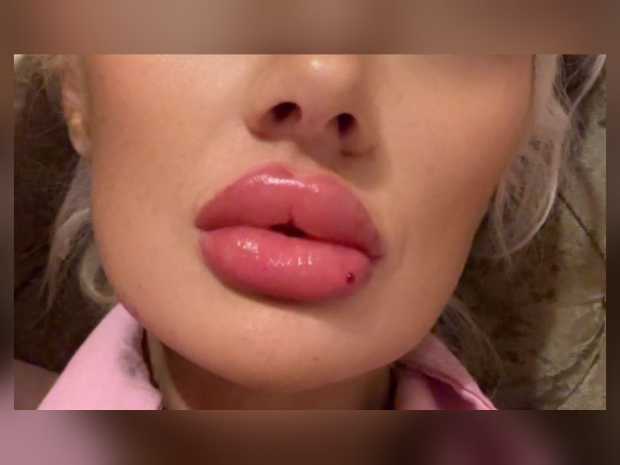 Finished lip enhancement result
